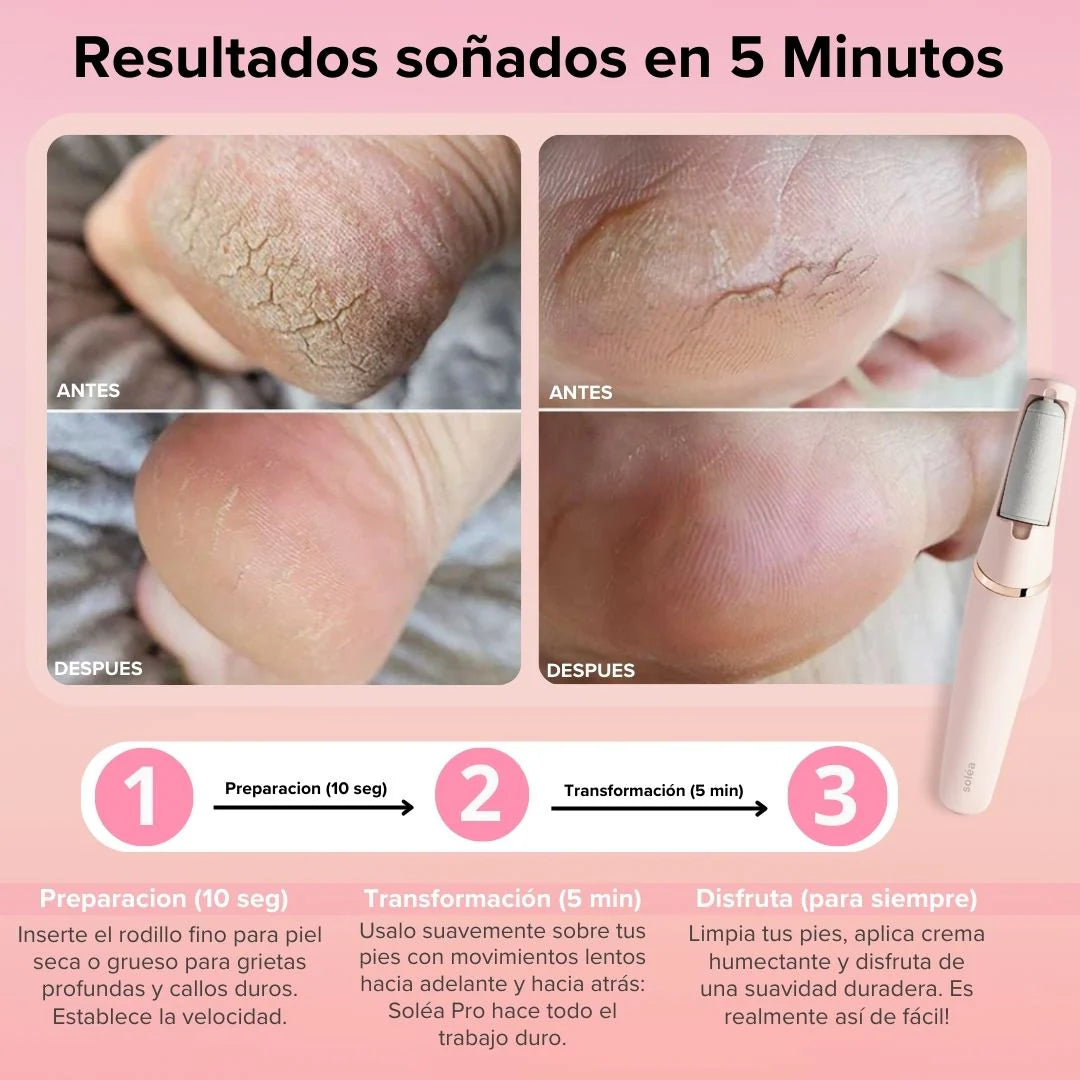Lima de Pies Eléctrica Profesional | OptiStore™
